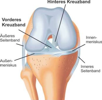 Ärzte unterscheiden daher bei der diagnose von knieschmerzen ganz genau, um welche art von schmerzen im knie es sich handelt. Kreuzbandriss: Diagnose und Therapie - Priv.-Doz. DDr ...
