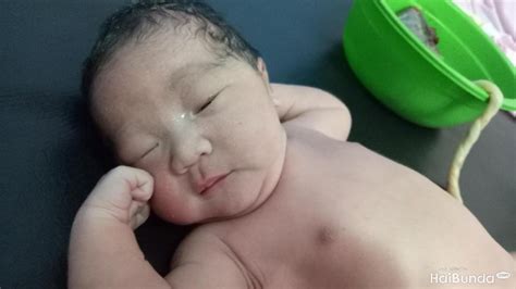 Apa hukum mengadzani bayi baru lahir? Yuk, Kenali Berbagai Masalah Kulit Bayi Baru Lahir