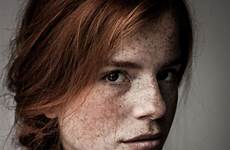 freckles beautiful freckled people redheads beauty hypnotize ll unique their who portrait