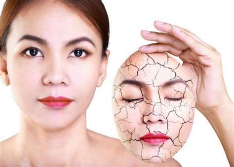 6+ Cara Mengatasi Kulit Kering dan Kusam Pada Wajah Dengan ...