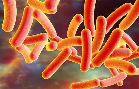 Legionnaires' disease in NYC: 10 things you should know - silive.com