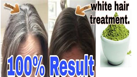 Premature white hair home remedies. WHITE HAIR TREATMENT | HOME REMEDY | 100% RESULT. - YouTube