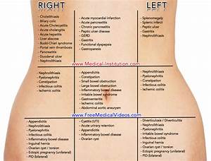 Abdominal Causes By Location And Quadrant Differential Diagnosis