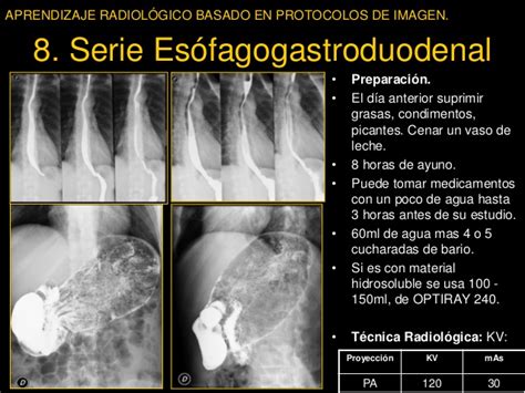 So candidates must focus on this topic and download this alphanumeric series pdf to get important questions with best solution regarding alphanumeric series. SERIE ESOFAGOGASTRODUODENAL PDF