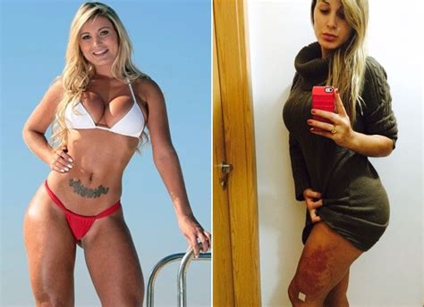 Andressa urach antes e depois cirurgias. EGO - Andressa Urach faz cirurgia para tirar produto que ...