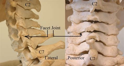 Orthopedic and surgical treatment of paralytic deformities of the spine is carried out using dorsal and ventral techniques by means of correction and polysegmental fixation of the spinal column. Facet Joint Interventions: Intra-Articular Injections ...