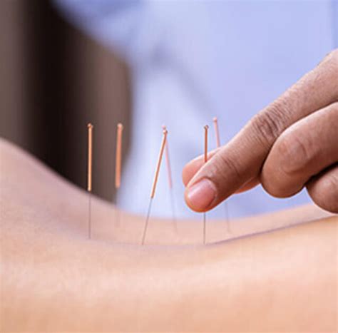 Die akupunktur (von lateinisch acus = nadel, und punctura < pungere = das stechen/stechen; Ab sofort Akupunktur in unserer Ordination | Dr. Shabpar