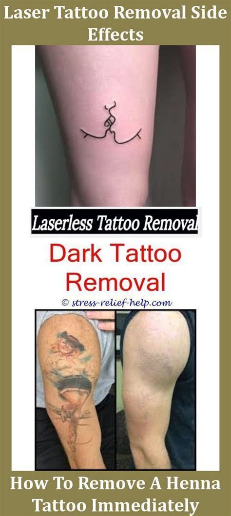 The light pulses fracture the pigment, shattering it into smaller pieces which are later removed by the body's immune system. How Much It Cost To Get A Tattoo Removed,new tattoo ...