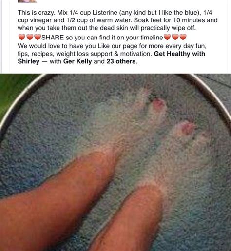 How to remove dead skin on your feet in just 24 hours.hey guys! HOW TO CLEAN THE DEAD SKIN OFF | Listerine, Hair health ...