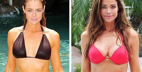 View agent, publicist, legal on imdbpro nominated for 1 primetime emmy. Denise Richards Breast Implants Plastic Surgery Before and ...