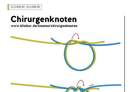 Dieser knoten zum verbinden von angelschnüren ist zur. Angelknoten binden: Der Chirurgenknoten - BLINKER