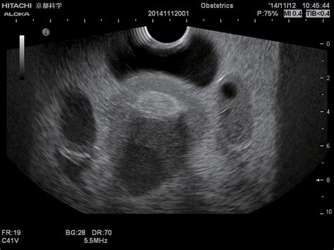 A test in which sound wave are used to examine internal structures. Female Pelvic Ultrasound Phantom at Imaging Solutions ...
