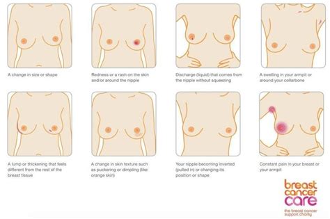 If you'd prefer to take care of everything. Breast Cancer Symptoms, Diagnosis And Treatment Explained ...