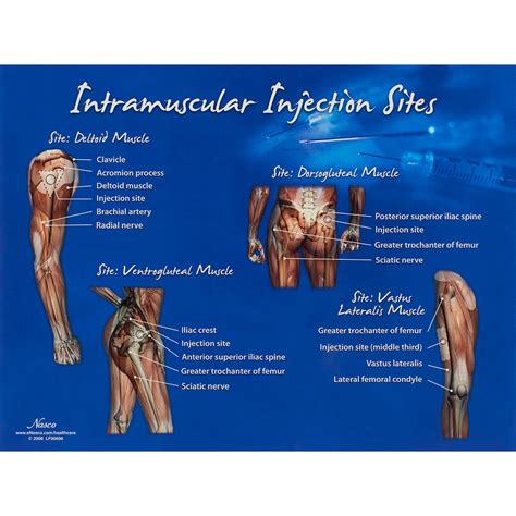 Intramuscular Injection Sites Chart - Nasco Healthcare