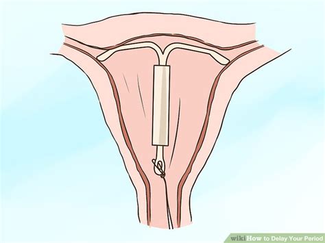 Check spelling or type a new query. Does birth control delay your period.