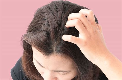 Cara ini dapat menghilangkan gatal yang disebabkan oleh dermatitis kontak, kudis, dan rambut yang tumbuh ke dalam atau ingrown hair. Kulit Kepala Gatal ? Atasi Dengan Tips Berikut Ini ...