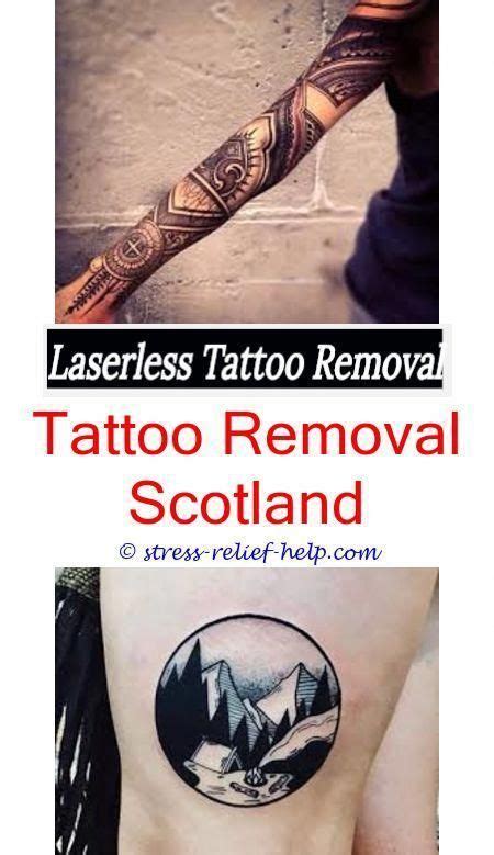 Laser tattoo removal is the safest and most effective means of eliminating an unwanted tattoo. Diy laser tattoo removal.How were tattoos removed before lasers.How does wrecking balm tattoo ...