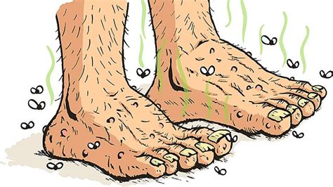 Your carpet provides comfort underfoot. Stinky Feet!!!! - Wellness Essentials