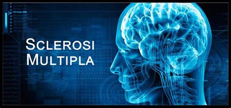 La sclerosi multipla (sm) è una malattia autoimmune che al momento non può essere curata. Sclerosi Multipla - Sintomi iniziali, Cause, Terapie ...