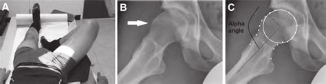 In this you are going to learn how to draw labelled diagram of frog easily for the classification of animals of kingdom animalia and phylum. (A) Frog-leg lateral radiographs of each hip were obtained ...