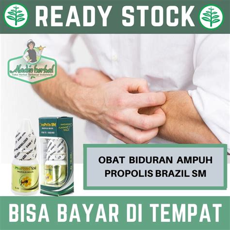 Biduran atau urtikaria merupakan kondisi dimana muncul bentol berwarna merah pada kulit yang disertai rasa gatal. Obat Biduran Herbal, Bentol Biduran, Alergi Dingin, Gatal - Gatal PALING AMPUH - PROPOLIS BRAZIL ...