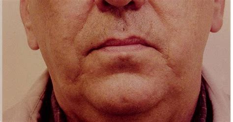 New procedure for saggy jowls! Performing Your Own Natural Facelift Using Facial Aerobics ...