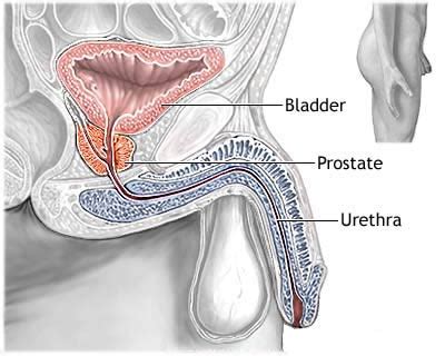 Tell your doctor or nurse if you have arthritis or have ever had any broken bones or surgery to the bones, as these will also show up on the scan. Enlarged prostate