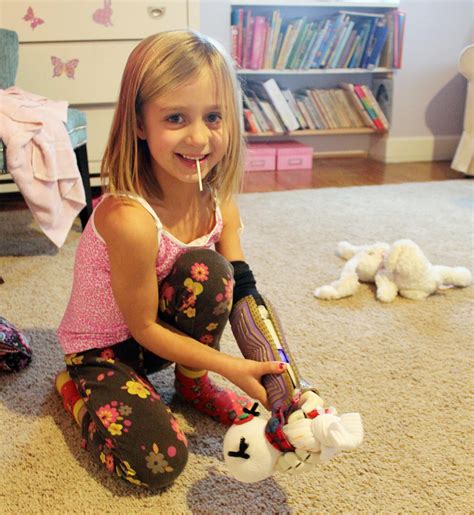 You have 2 free articles left. Holiday Miracle - 3D Printed Myoelectric Arm Allows Girl ...