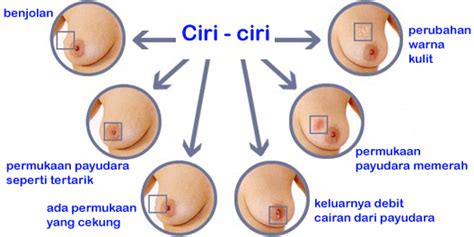 Pada tahap inisiasi karsinogen bereaksi. Makanan Yang Tidak Di Anjurkan Bagi Penderita Kanker ...