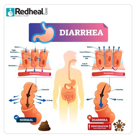 Pin by Redheal on Healthy Lifestyle * | Health, Body ...
