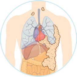 Check spelling or type a new query. Biphasic Malignant Mesothelioma