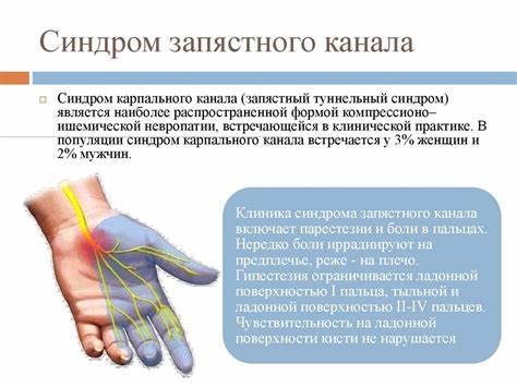Диета при туннельном синдроме