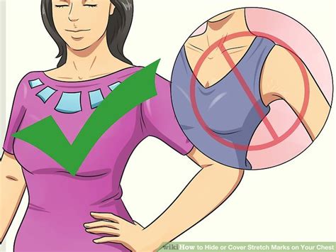 How to draw stretch marks. 4 Ways to Hide or Cover Stretch Marks on Your Chest - wikiHow