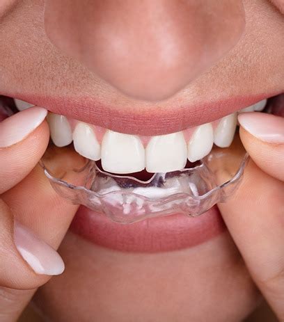 Here you may to know how to clean your invisalign trays. Invisalign Belmont, MA | Clear Braces | Cosmetic Dentist