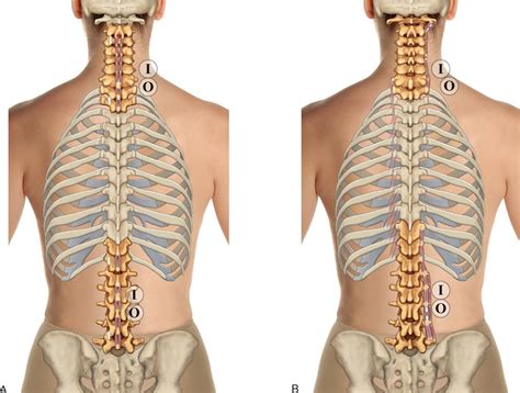 The rib cage is an arrangement of bones in the thorax of all vertebrates except the lamprey. Rib Cage Labeled Posterior View - Rib Cage Posterior View ...