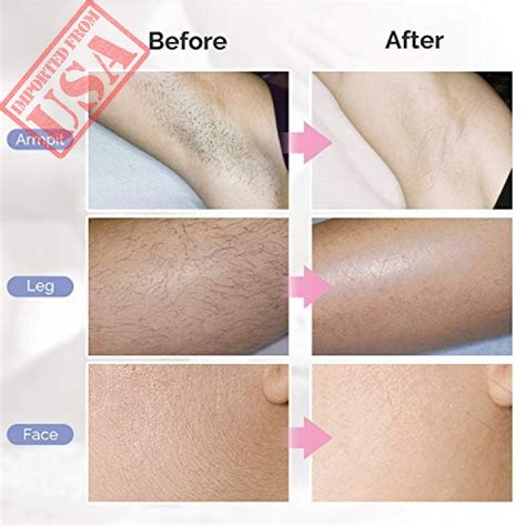 But thanks to these modern facial hair removal devices through these devices, you can remove your hairs at home without pain and allergic reaction. IPL Hair Removal System for Women and Men IPL Hair Removal ...