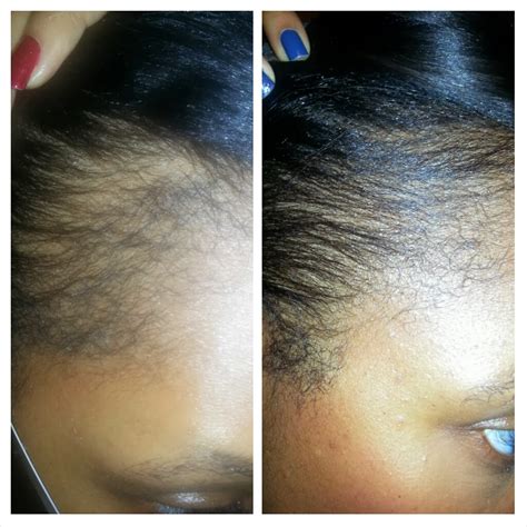 Castor oil is a natural protective coat for your locks. Finally Growing...Life As I Know It...: Relaxer Update ...