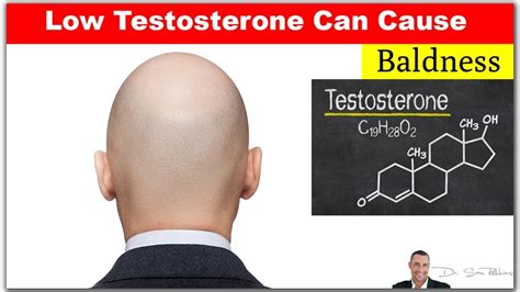 But to treat the hair loss you need to get to the root of the problem. Does Testosterone Cause Hair Loss | Uphairstyle