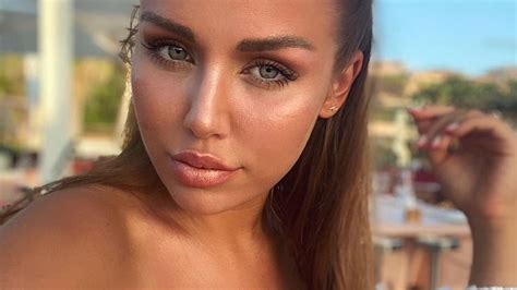 Eure kim immer mit dabei: "Nur noch Schwarz gesehen": Kim Gloss ist im Krankenhaus ...