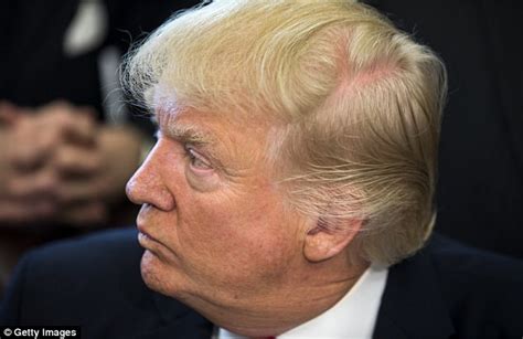 If you love hairy babes, you will be satisfied beyond reason here! Donald Trump's hair loss drug tied to severe side effects ...