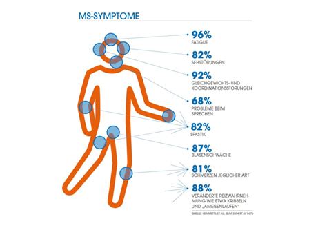 Encephalomyelitis disseminata) wird in der medizin als autoimmunerkrankung klassifiziert. 10 häufige Symptome bei Multipler Sklerose - RatGeberZentrale