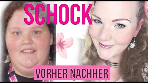 Schönes, kräftiges und wunderbar gesund glänzendes haar wünschen sich männer und während die präparate für männer 5 prozent minoxidil enthalten, verfügen die präparate für frauen über eine konzentration von 2 prozent minoxidil. Schock!! Abnehmen vorher nachher Bilder - One day in my ...
