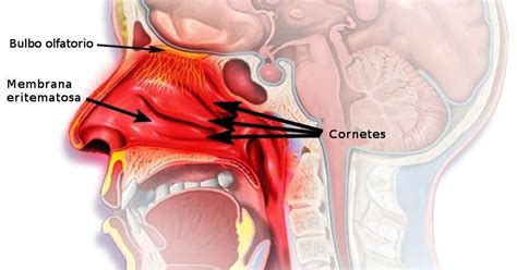 Bola mata (bubus oculi), atau organ penglihatan, berada pada kavitas orbita, dimana organ ini dilindungi dari cedera dan. Rinitis: Definisi, Penyebab dan Gambaran Klinis - MITRA KESMAS