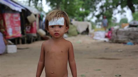 Cambodian injured kid in slums in phnom penh city Stock Footage,#kid#slums#Cambodian#injured 
