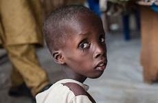 starving nigerian suffering glued