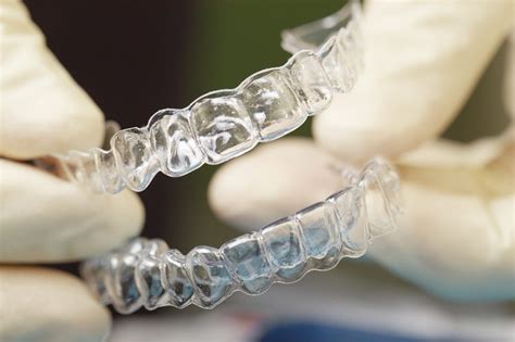 If the chip exposes the dentin or pulp of the tooth, an infection may. Invisalign in the Philippines: The Process and Cost ...