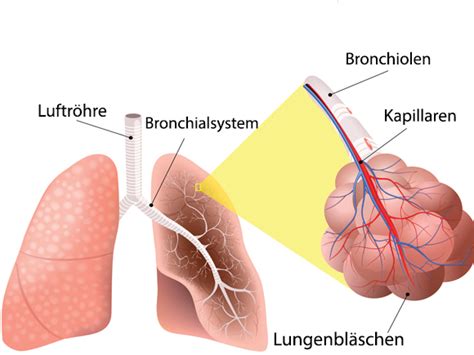 Hier zeigen sich manchmal symptome einer schnell fortschreitenden herzschwäche. Lungenödem (Wasser in der Lunge): Symptome, Stadien ...