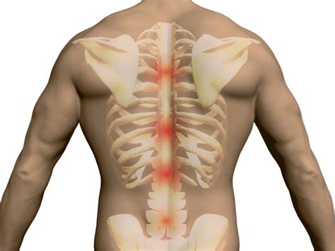Vertebral column & rib cage pictures. Have You Got Muscles Outside Rib Cage : How To Build The ...