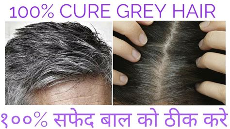 Get away grey supplements recover the amount relating to catalase in your body, allowing it to fight hydrogen peroxide. How to cure grey hair by Homeopathic medicine | For Public ...