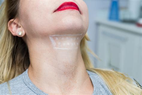 You might notice lines forming from the crease of your nose down to. Jowls: Causes, Prevention and How To Get Rid of Them